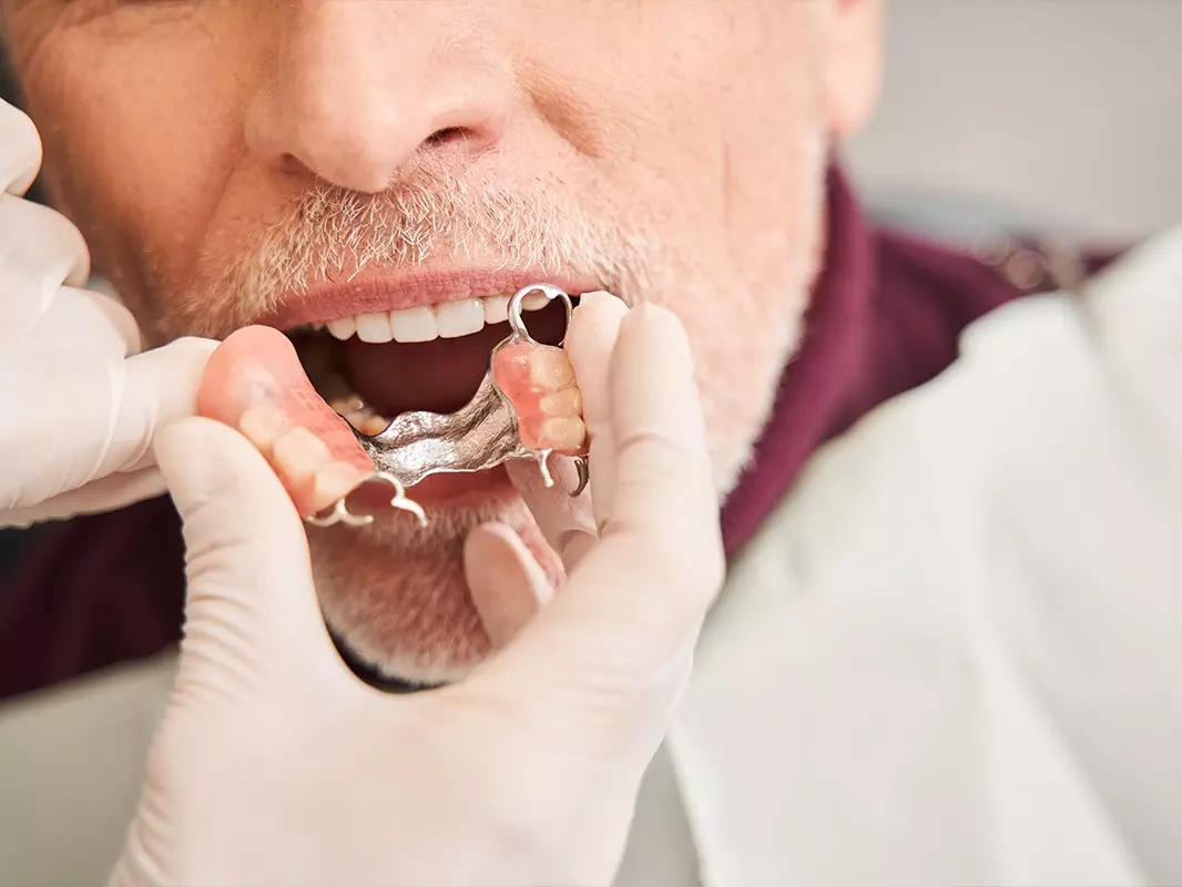 Dentures