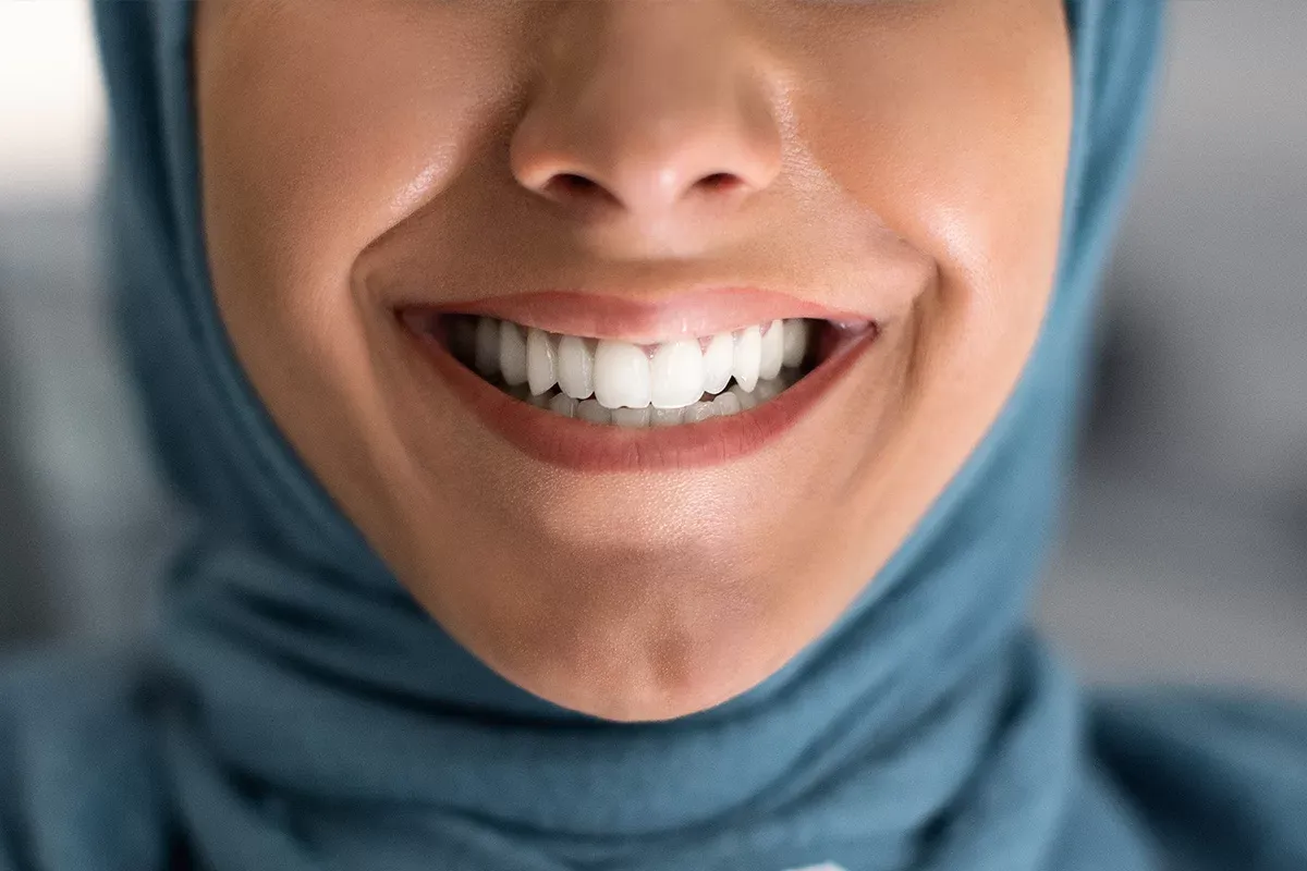 Teeth Whitening Treatment